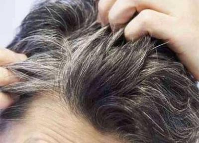 نشانه هایی که موها در خصوص سلامتی به ما متذکر می شوند